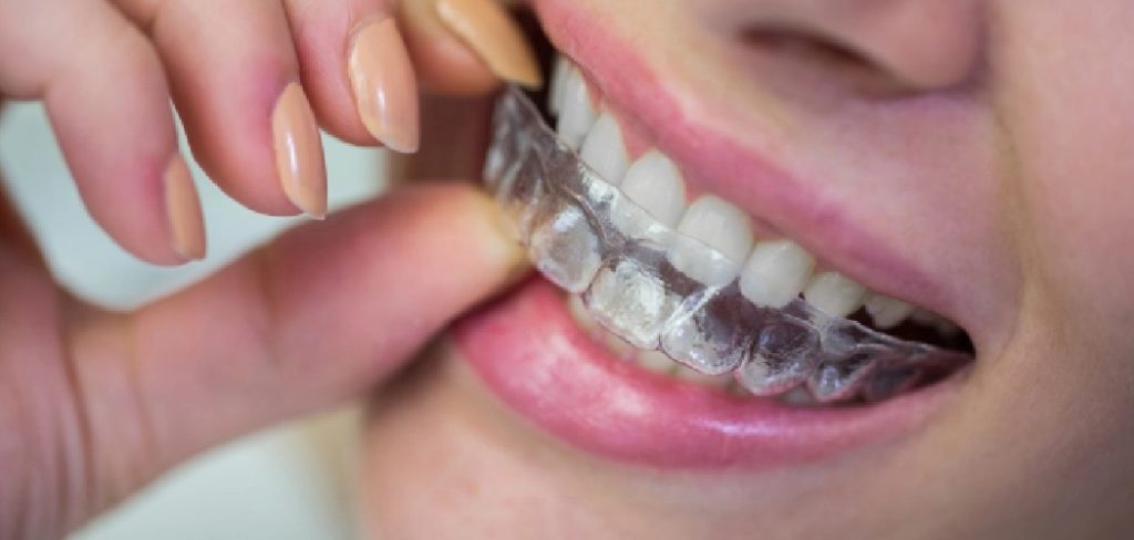 How to Repair Broken Retainer